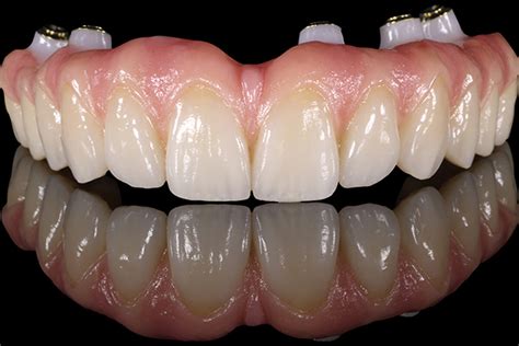  Zirconia-Ge Guelph! De Keramische Wonderstof Voor Implanteren En Verbinden